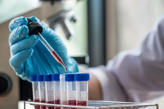 newborn biology, through tiny blood samples