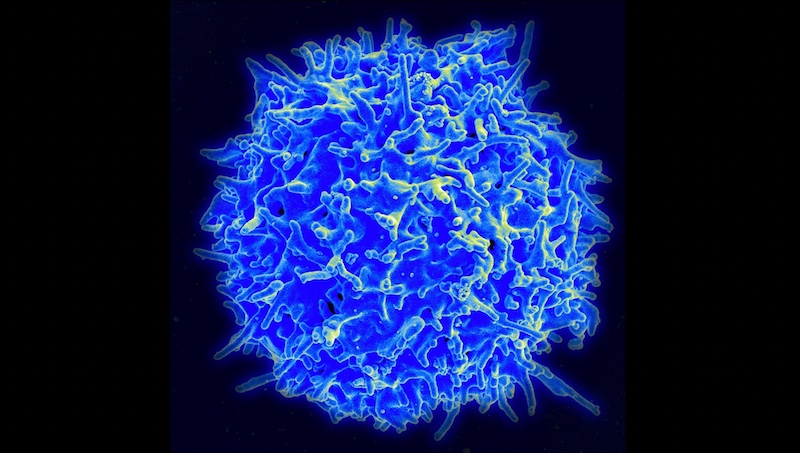 T cell multiple sclerosis