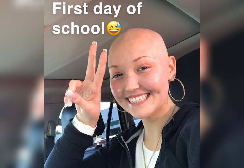 Darcey, who has Li-Fraumeni syndrome, went bald for her first day of school