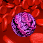 Could leukemia be stopped before it starts?