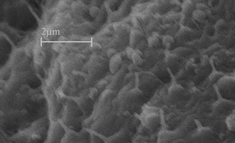 scanning electron microscopy image of a developing mouse brain