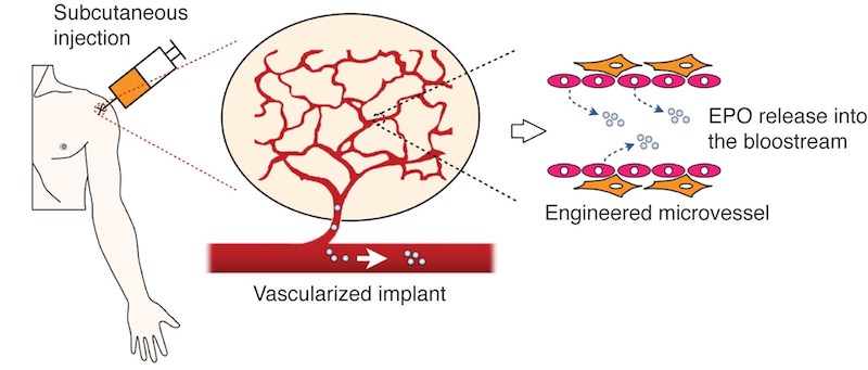 schematic for making blood vessels that secrete erythropoiein