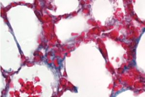 collagen in lung cells