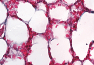 Deletion of PAD4 gene prevents collagen deposition in lung cells