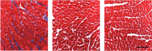 fibrosis in mouse heart tissue, with PAD4 gene deletion