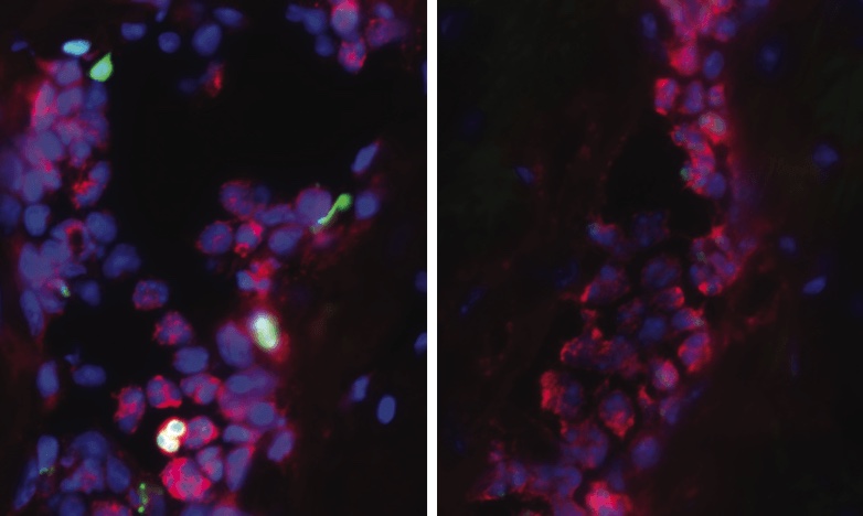 neutrophil extracellular traps and their block by PAD4 gene deletion
