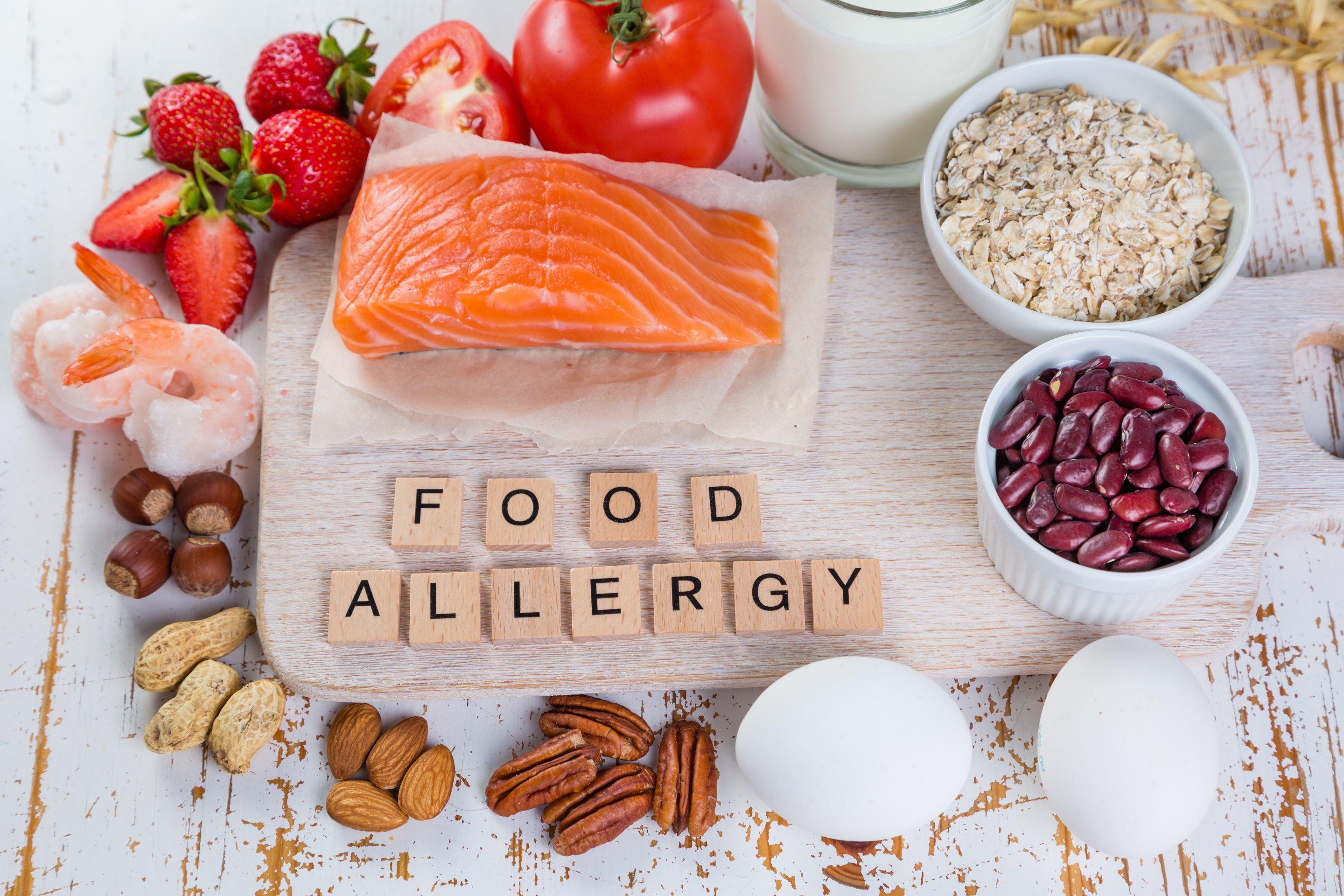 Picture of common food allergens