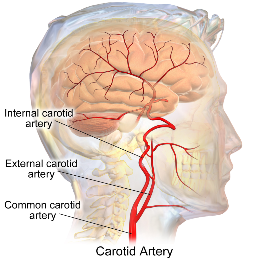 Illustration of the carotid artery entering the brain