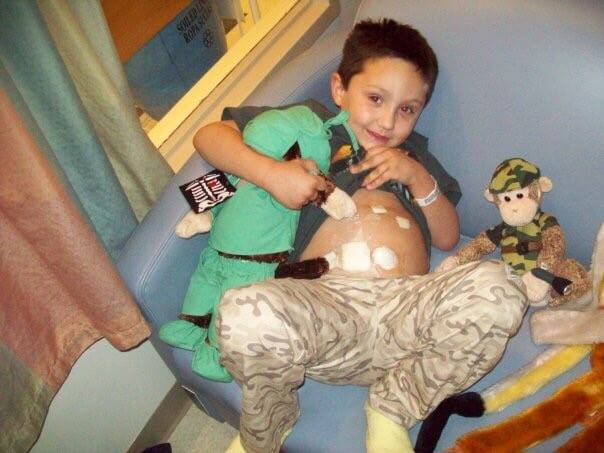 Josh, who had surgery for his adrenal gland disorder, shows his scars.