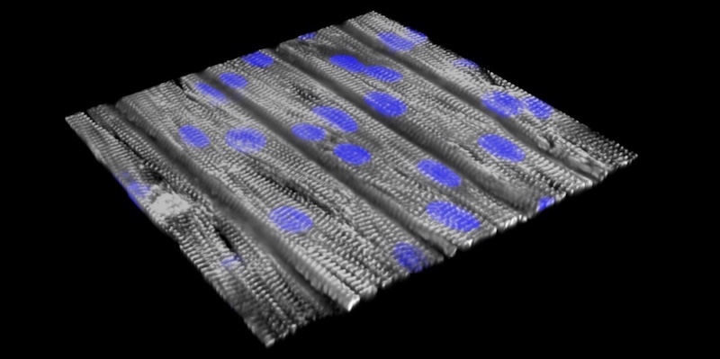 Tissue model of CPVT