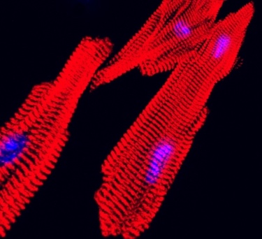 cardiomyocytes from mice with CPVT