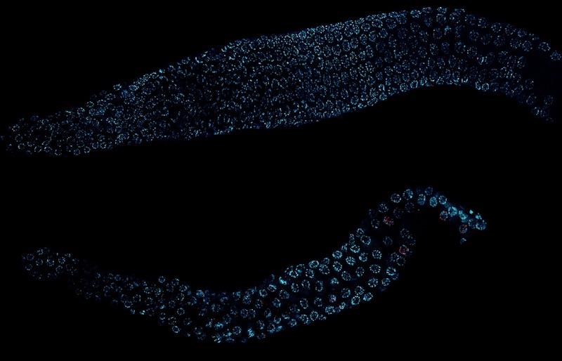 The worm on the bottom has a mutation that affects its epigenetics