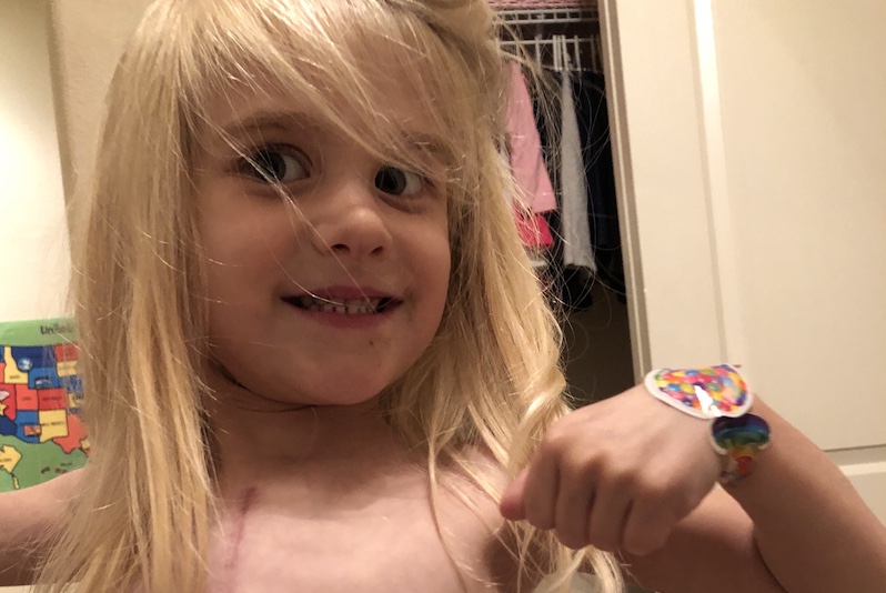Elyse, who had a biventricular repair for heterotaxy, shows off her scar.