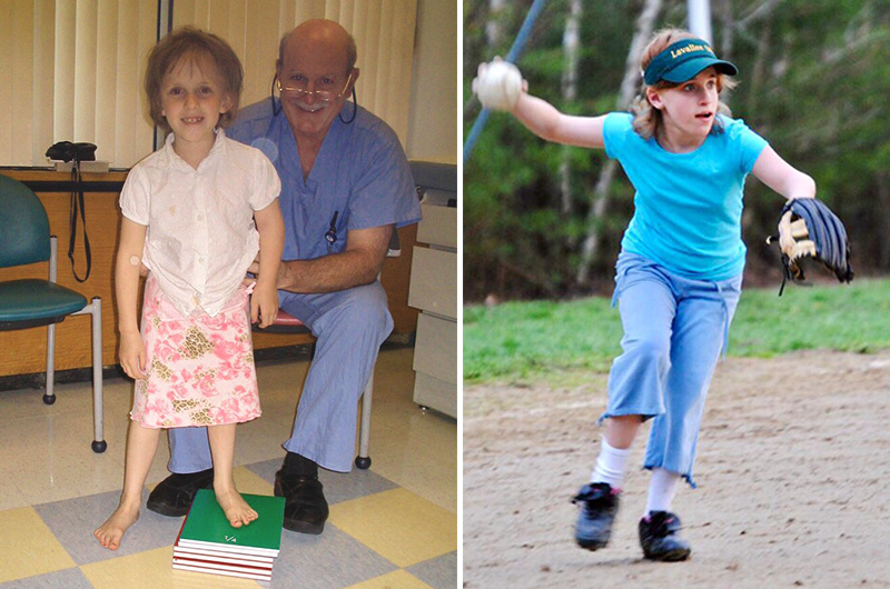 Two photos of Lauren, one at age 7, with her left leg on a stack of books showing the difference between her two legs; the second of her playing softball.