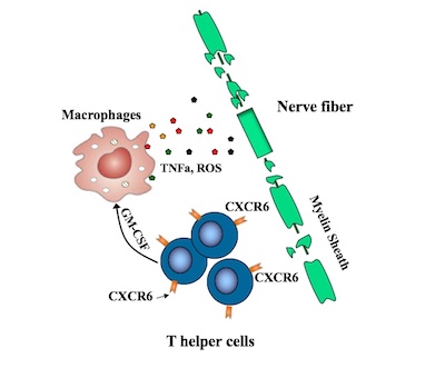 CXCR6 T helper cells in multiple sclerosis