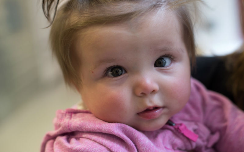 Charlotte, who got a second opinion before she was born, smiles