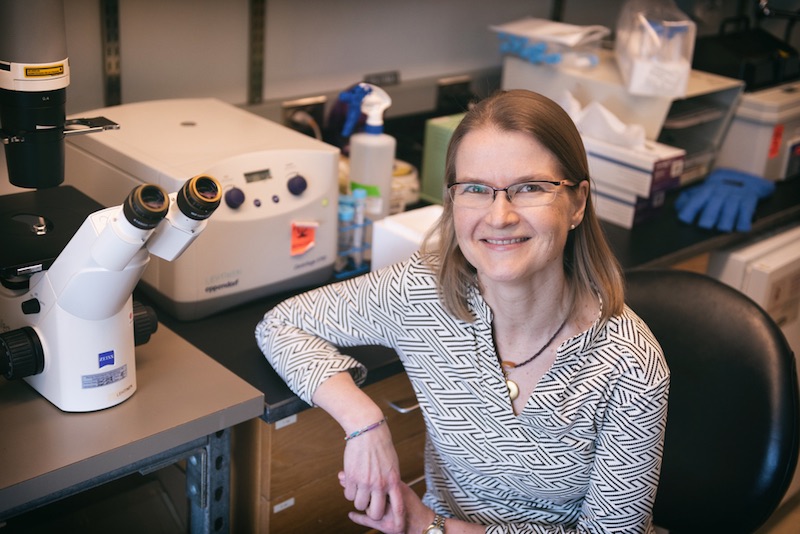Maria Lehtinen, PhD, studies the choroid plexus