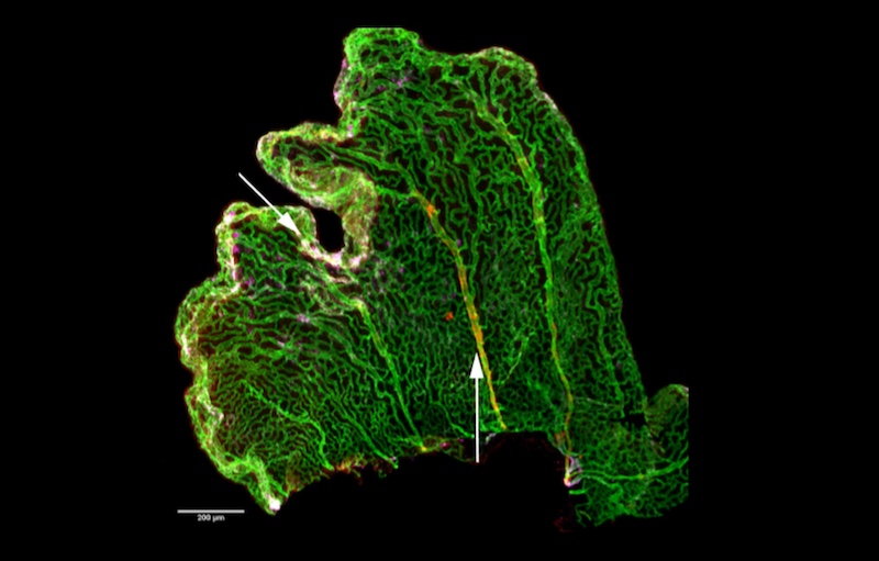 embryonic choroid plexus