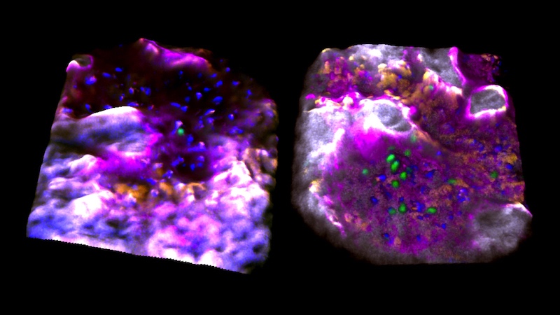 blood stem cells in the surface of the bone, while 'sleeping' and 'awake'