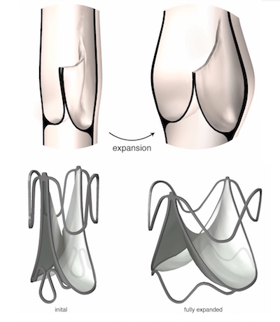 venous valve and bileaflet heart valve