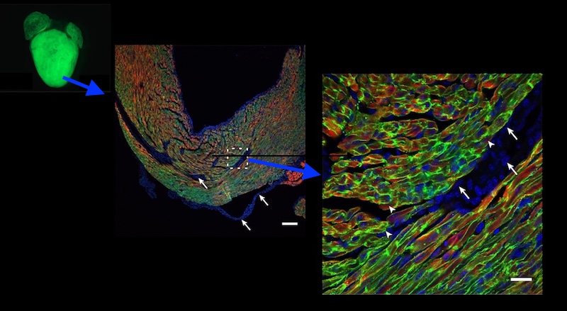 A gene therapy vector being taken up in the heart
