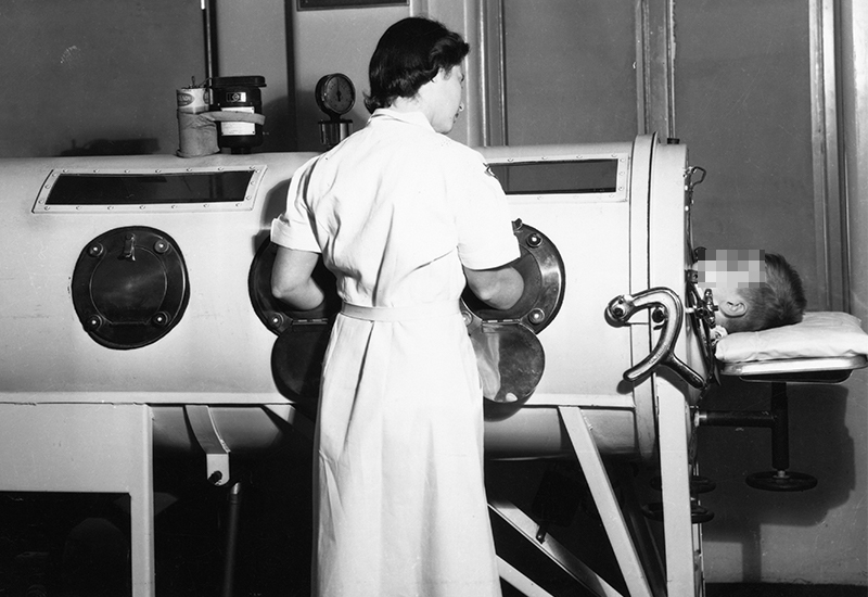 A physical therapist cares for a young boy in an iron lung