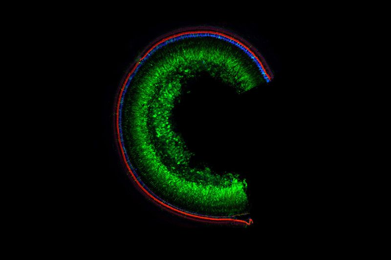 microscope image of mouse cochlea with repaired Tmc1 gene