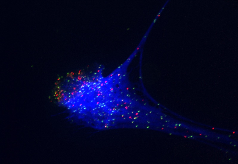a neutrophil forming neutrophil extracellular traps (NETs)