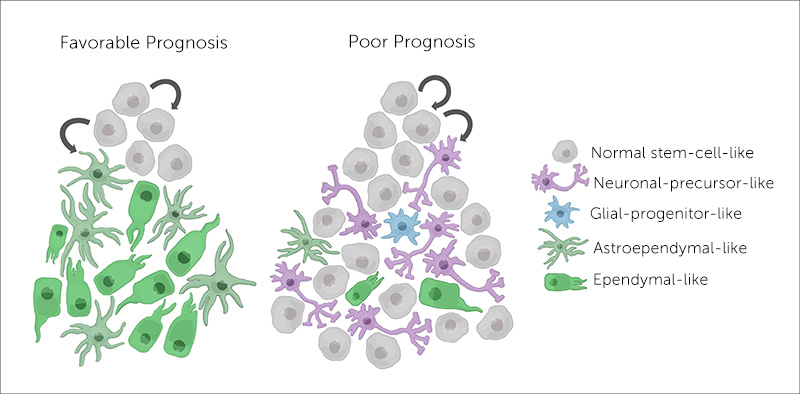 ependymoma cells of origin