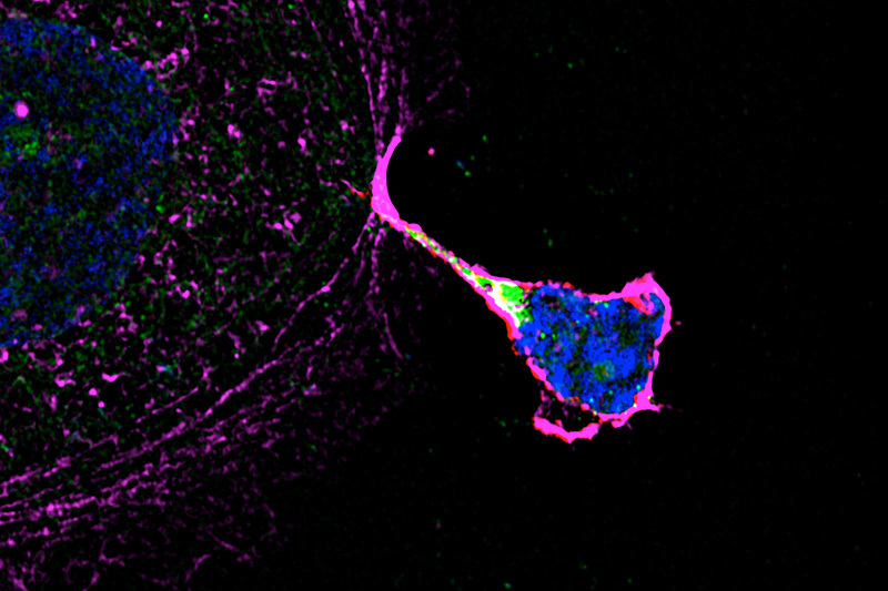 image of natural killer cell sprouting nanotube to a placenta cell and transferring granulysin