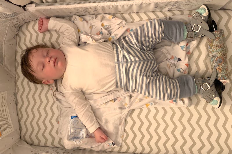 Gabriel, who was born with clubfoot, sleeping in his crib, wearing a brace that holds his feet in an outward position.