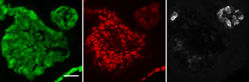 lung organoids markers