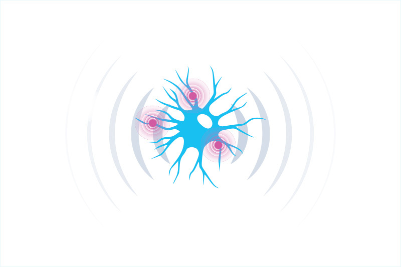 illustration of inflamed nerve cell