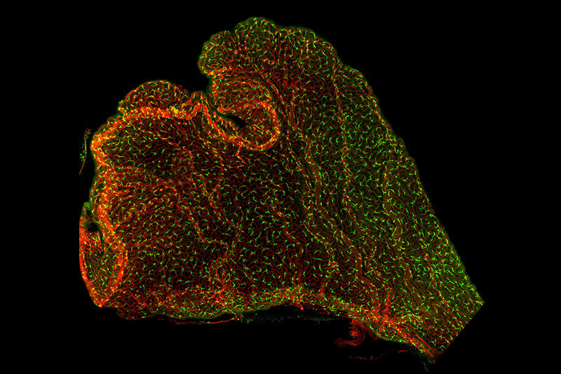 choroid plexus with immune cells