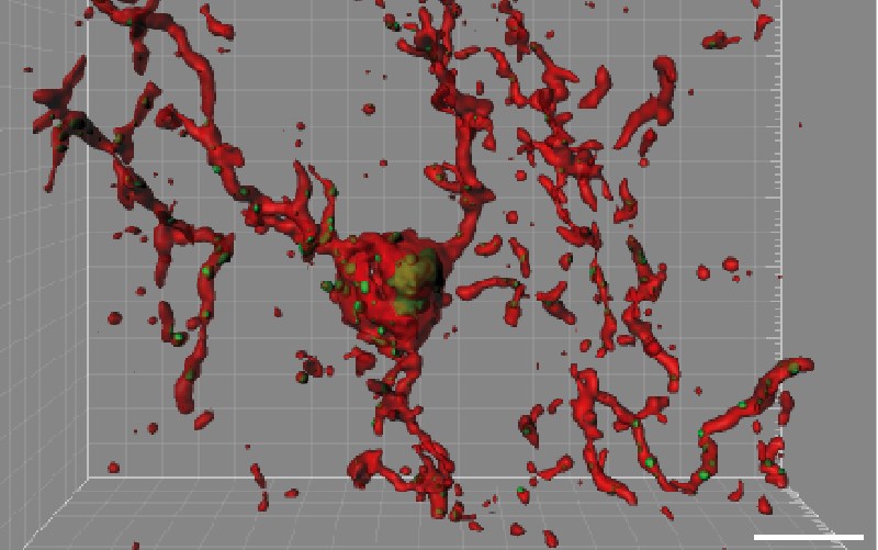 microglia ingesting synapses