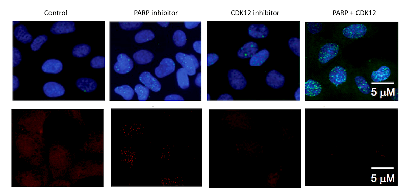 how PARP and CDK12 inhibitors combine to deal a lethal blow to Ewing sarcoma