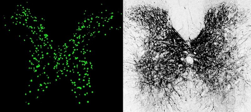 A cross section of a mouse spinal cord, stained two different ways, showing increased expression of KCC2 in inhibitory neurons.