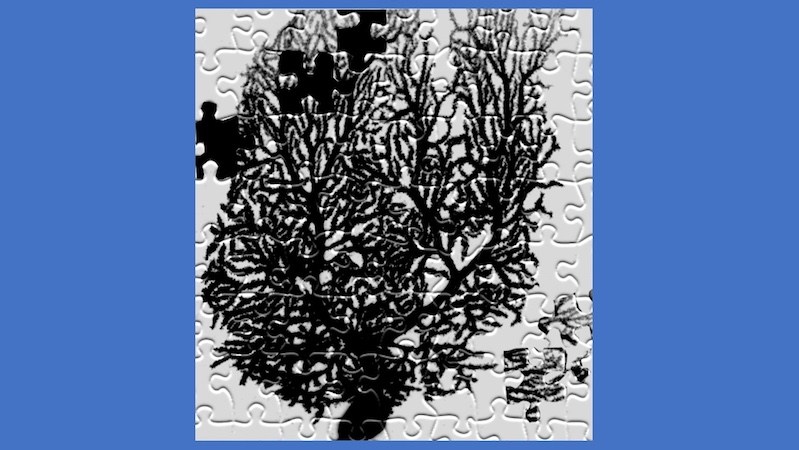 tuberous sclerosis and autism concept