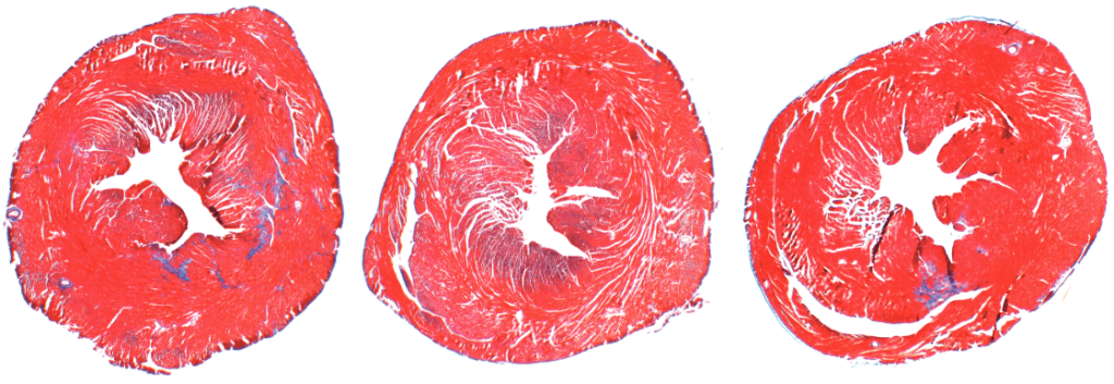 mouse hearts show differing levels of fibrosis