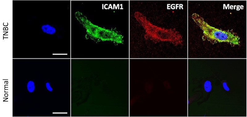 triple-negative breast cancer cells stained for ICAM1 and EGFR receptors