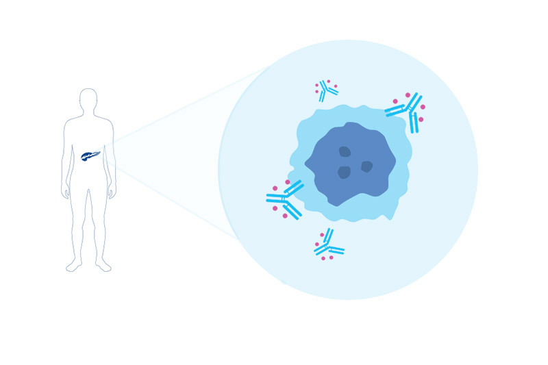 targeted treatment for pancreatic cancer