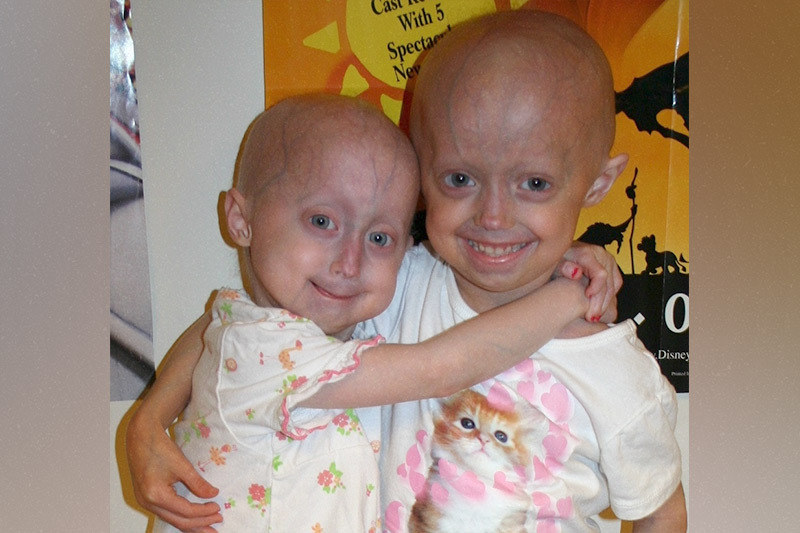 Photo of Meghan Waldron and Megan Nighbor, the first two children in the first lonafarnib clinical trial at Boston Children's in 2007.