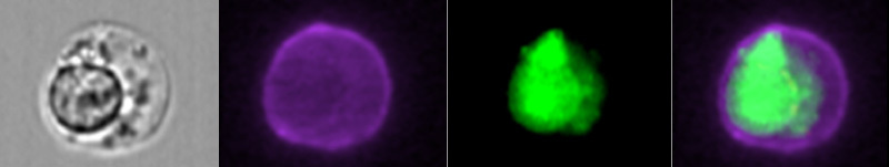 4 still images in sequence. First is infected red blood cell. Second is gamma delta T cell. Third is malaria parasite. Fourth is parasite ingested by T cell.
